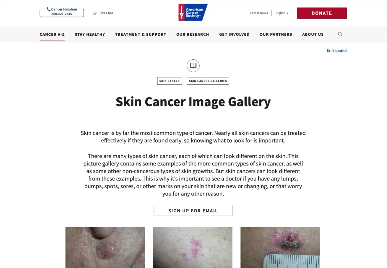 Pre 2021 Skin Cancer Gallery page design.